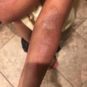 All Over Body Balm photo review