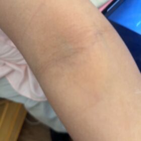 All Over Body Balm photo review