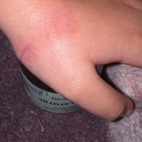 All Over Body Balm photo review