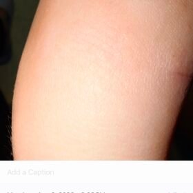 All Over Body Balm photo review