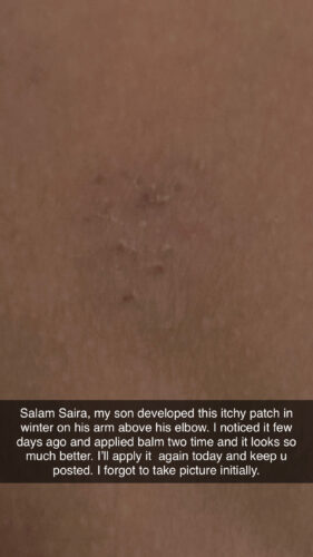 All Over Body Balm photo review